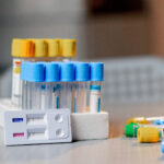 close-up in a veterinary clinic there are test tubes of different colors with tests on the table