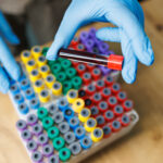 Test tubes with blood. Taking blood from a vein for research